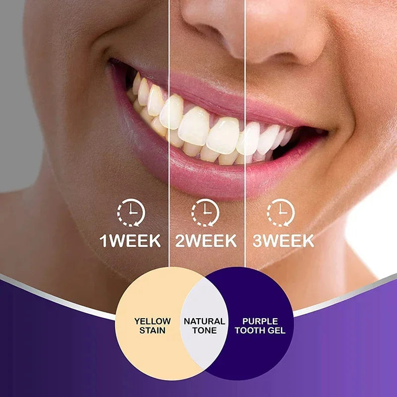 Hismile v34 purple whitening tooth paste (Guaranteed Result)