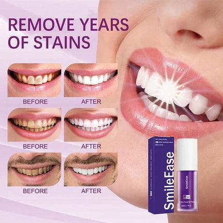 Hismile v34 purple whitening tooth paste (Guaranteed Result)